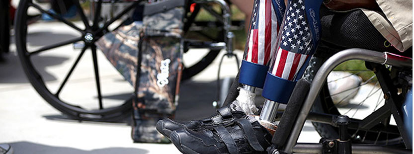 Veteran with prosthetic legs